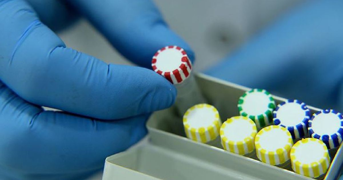 Ankara Üniversitesi: Koronavirüs’ü izole ettik 